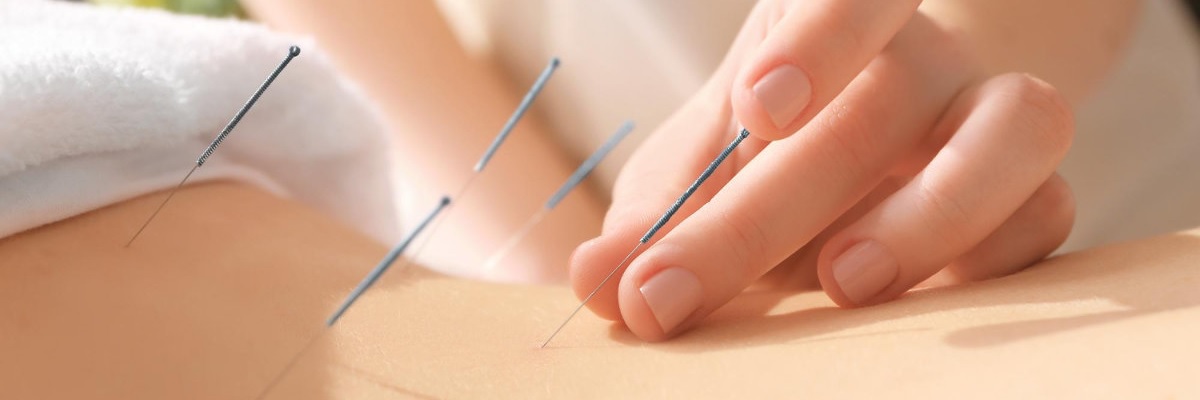 akupunktura w celmed